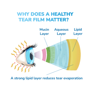 Why does a healthy tear layer matter?